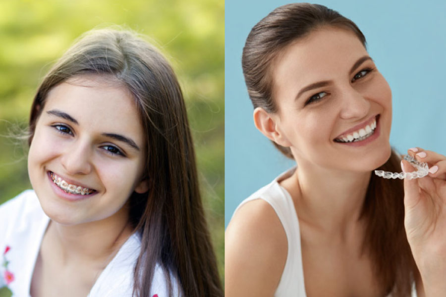 One smiling teen girl has traditional braces and the other has Invisalign.