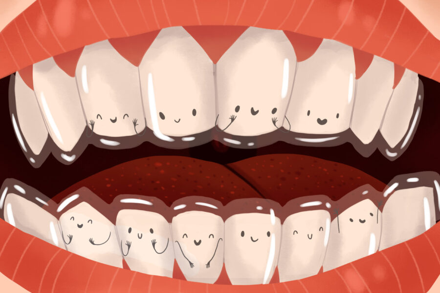 Illustration of clear Invisalign aligners on a person's teeth