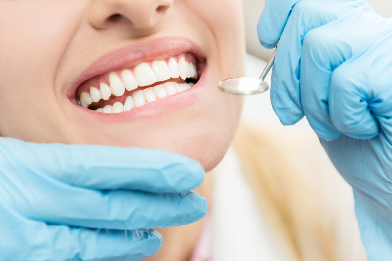 Closeup of a woman smiling as a blue gloved hand holds a dental mirror to examine her teeth during a routine dental cleaning