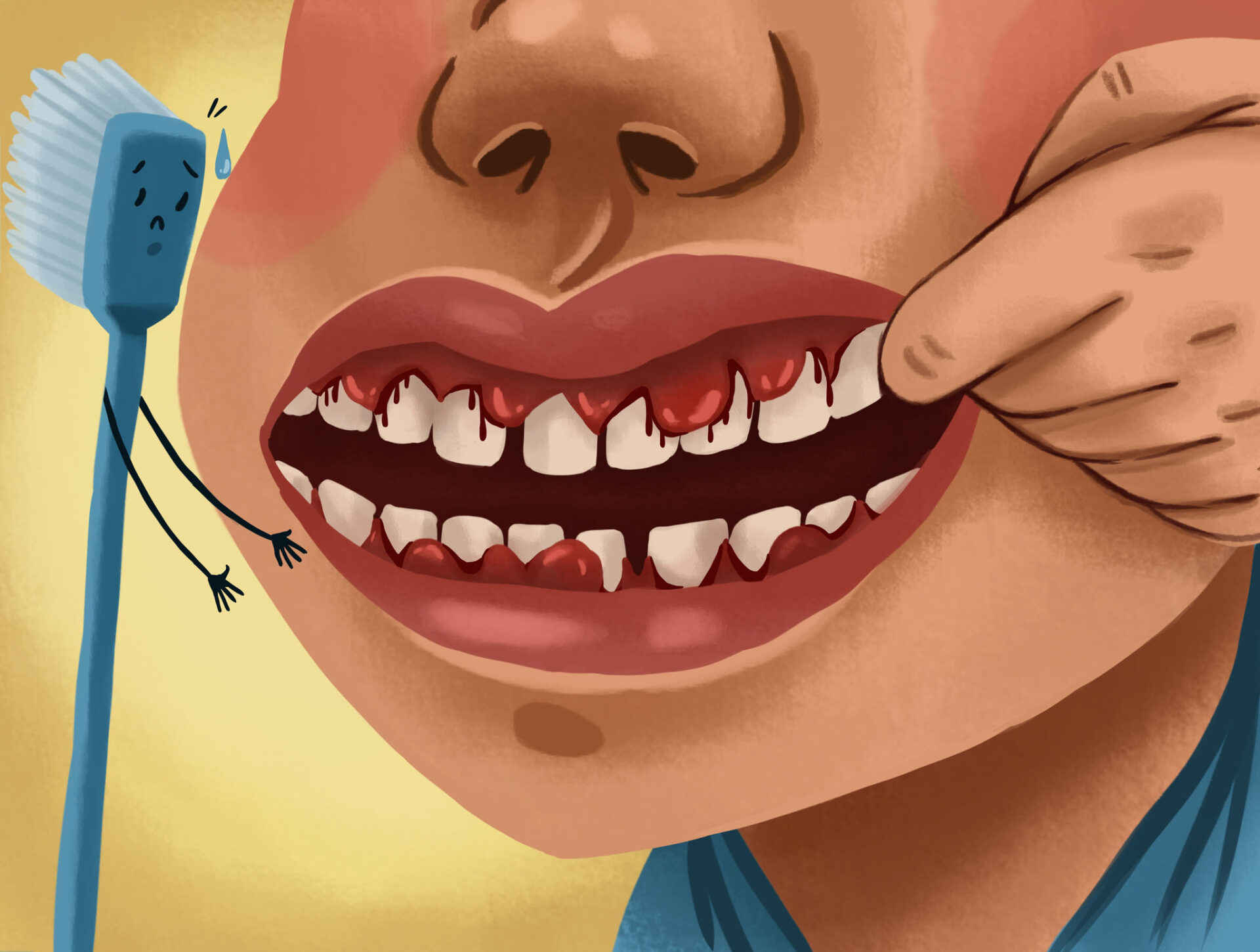 Graphic illustration of person with bleeding gums, an example of a common dental problem.